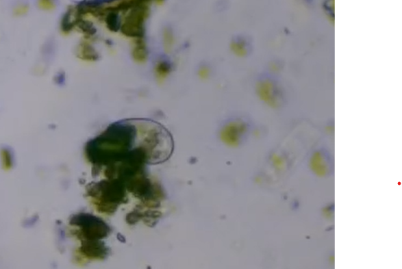 Vidéo de protozoaire