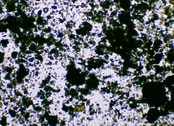 Nématode