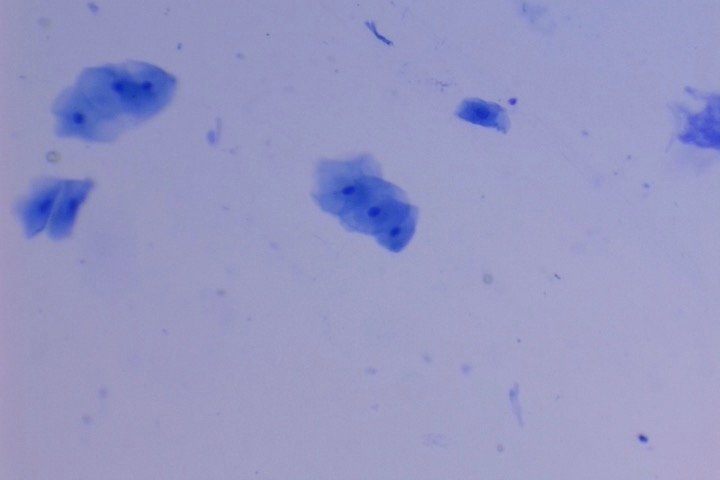 Noyaux cellulaires de salive colorés au bleu de méthylène